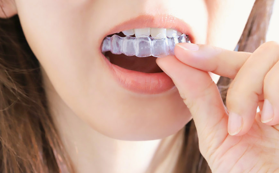 小児矯正・マウスピース矯正に注力寄り添うサポート体制